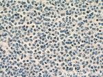 TLX1 Antibody in Immunohistochemistry (Paraffin) (IHC (P))