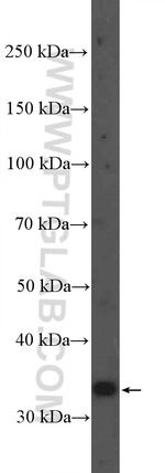 TLX1 Antibody in Western Blot (WB)