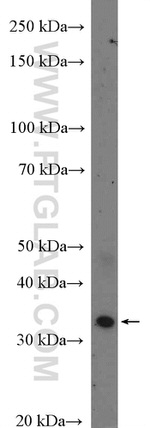 TLX1 Antibody in Western Blot (WB)