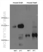 SLC4A3 Antibody in Western Blot (WB)