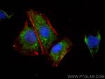 BRINP2 Antibody in Immunocytochemistry (ICC/IF)