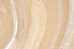 BRINP2 Antibody in Immunohistochemistry (Paraffin) (IHC (P))