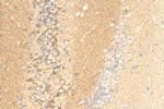 BRINP2 Antibody in Immunohistochemistry (Paraffin) (IHC (P))
