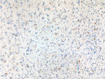 TRIM47 Antibody in Immunohistochemistry (Paraffin) (IHC (P))