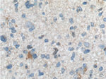 TRIM47 Antibody in Immunohistochemistry (Paraffin) (IHC (P))
