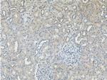 TRIM47 Antibody in Immunohistochemistry (Paraffin) (IHC (P))