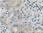 TRIM47 Antibody in Immunohistochemistry (Paraffin) (IHC (P))