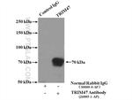 TRIM47 Antibody in Immunoprecipitation (IP)