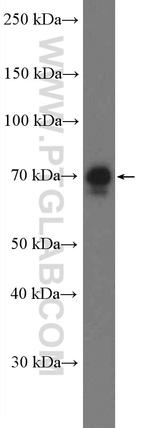 TRIM47 Antibody in Western Blot (WB)