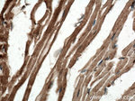 SCAMP3 Antibody in Immunohistochemistry (Paraffin) (IHC (P))