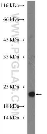 IFT22 Antibody in Western Blot (WB)