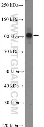 CWC22 Antibody in Western Blot (WB)