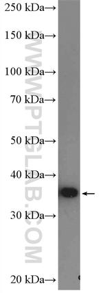 AMPK beta 1 Antibody in Western Blot (WB)