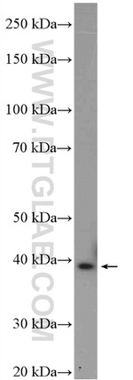 AMPK beta 1 Antibody in Western Blot (WB)