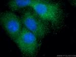 Uteroglobin Antibody in Immunocytochemistry (ICC/IF)