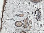 Integrin beta-1 Antibody in Immunohistochemistry (Paraffin) (IHC (P))