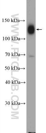 Integrin beta-1 Antibody in Western Blot (WB)