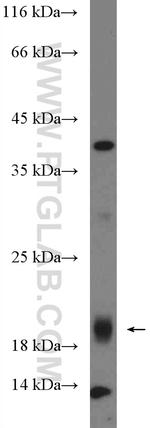 CXorf38 Antibody in Western Blot (WB)