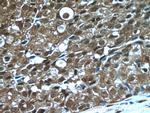 PSMD9 Antibody in Immunohistochemistry (Paraffin) (IHC (P))