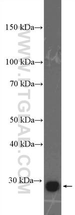 PSMD9 Antibody in Western Blot (WB)