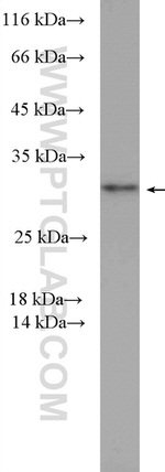 PSMD9 Antibody in Western Blot (WB)