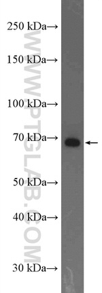ADAM12 Antibody in Western Blot (WB)
