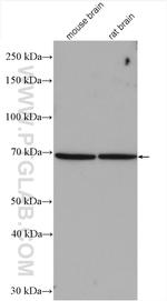 ADAM12 Antibody in Western Blot (WB)