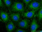SPTB Antibody in Immunocytochemistry (ICC/IF)