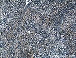 IARS Antibody in Immunohistochemistry (Paraffin) (IHC (P))