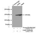 IARS Antibody in Immunoprecipitation (IP)