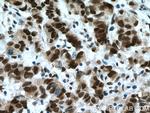 USP7 Antibody in Immunohistochemistry (Paraffin) (IHC (P))