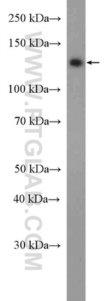 USP7 Antibody in Western Blot (WB)