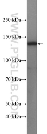 USP7 Antibody in Western Blot (WB)