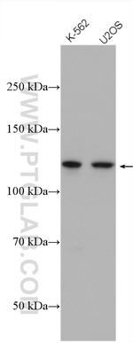 USP7 Antibody in Western Blot (WB)