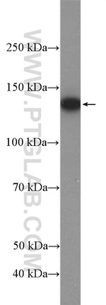 USP7 Antibody in Western Blot (WB)