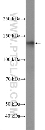 USP7 Antibody in Western Blot (WB)