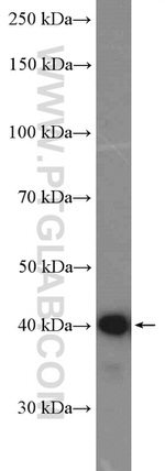 FCRLA Antibody in Western Blot (WB)