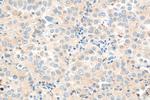 OR2H1 Antibody in Immunohistochemistry (Paraffin) (IHC (P))