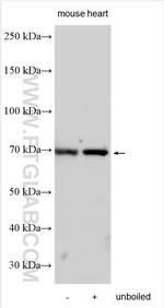 SLC2A12 Antibody in Western Blot (WB)