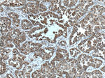 Bcl-XL Antibody in Immunohistochemistry (Paraffin) (IHC (P))