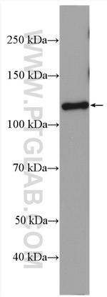 PAM Antibody in Western Blot (WB)