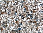 TTYH1 Antibody in Immunohistochemistry (Paraffin) (IHC (P))