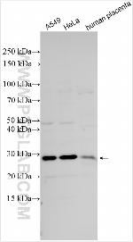 RIT1 Antibody in Western Blot (WB)