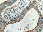 Cystatin S Antibody in Immunohistochemistry (Paraffin) (IHC (P))