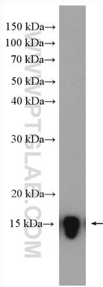 Cystatin S Antibody in Western Blot (WB)