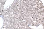 COL10A1 Antibody in Immunohistochemistry (Paraffin) (IHC (P))