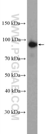 Calpain 7 Antibody in Western Blot (WB)