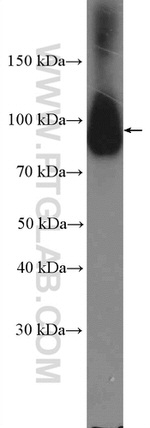 Calpain 7 Antibody in Western Blot (WB)