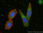 RASGRP1 Antibody in Immunocytochemistry (ICC/IF)