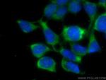 CITED1 Antibody in Immunocytochemistry (ICC/IF)